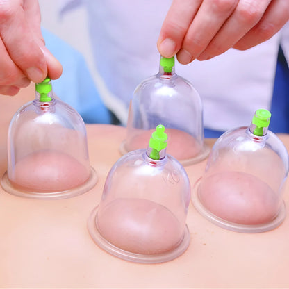Vacuum Cupping Set 6 Pcs Kit