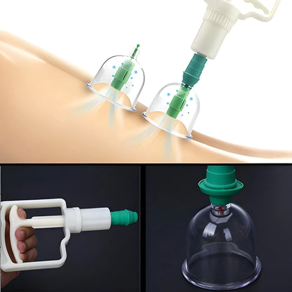 Vacuum Cupping Set 6 Pcs Kit